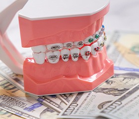 A braces model set on top of several hundred-dollar bills