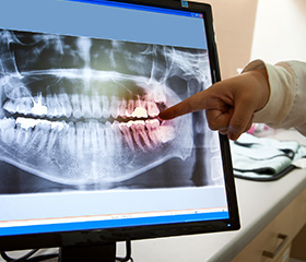 Digital x-rays on computer