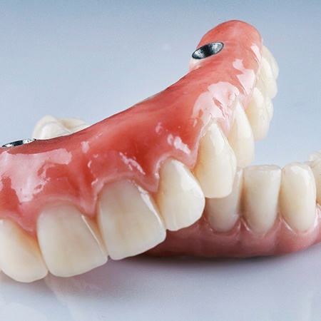 An All-on-4 denture 