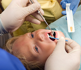 Child receiving dental sealants