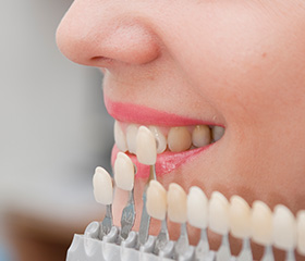 Closeup of teeth compared with color shading chart