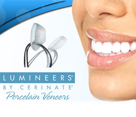 Closeup smile and Lumineers logo