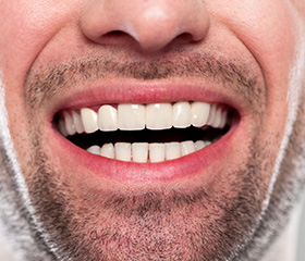 Closeup of healthy smile