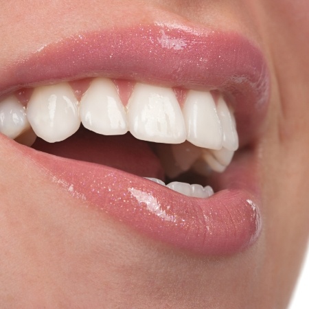 Close up of a persons smile