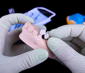 Model smile with fixed bridge restoration
