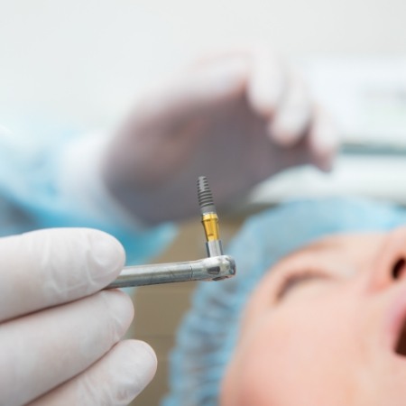 Oral surgeon with a dental implant