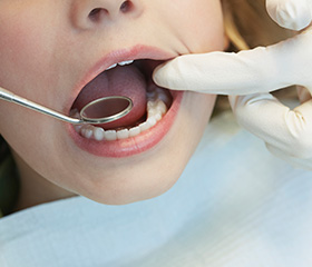 Closeup of patient during dental care