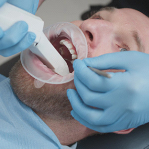 Close-up of male dental patient having digital impression taken