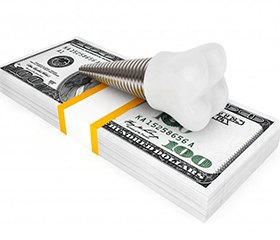 dental implant post with crown lying on top of a stack of money