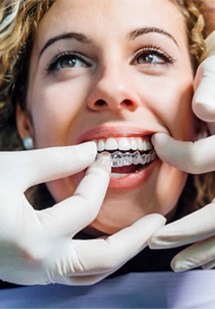 patient getting Invisalign from dentist 