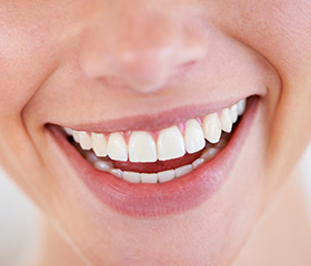 Closeup of flawless teeth