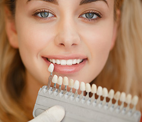 Woman's smile compared with tooth shade charts