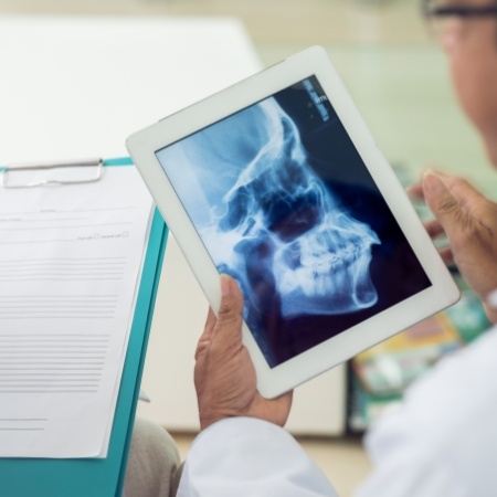 Looking at X ray of jaw