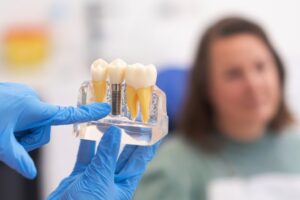 a gloved hand pointing to a model of a dental implant with a patient in the background
